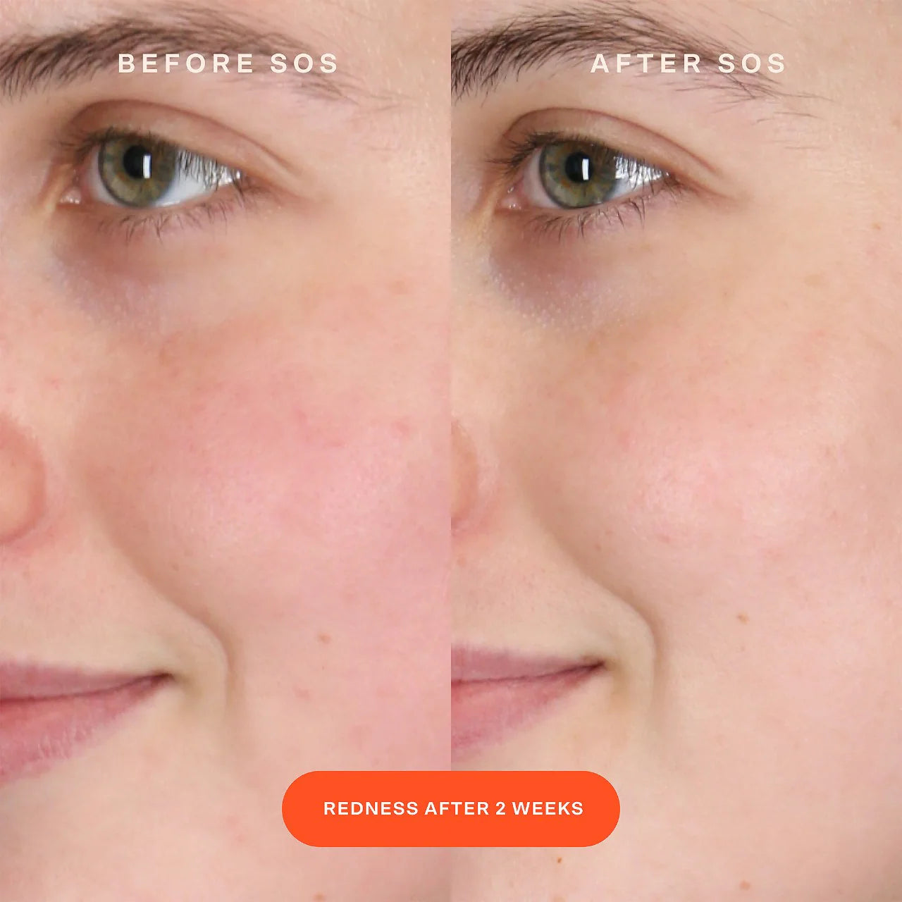 Tower 28 - SOS Intensive Redness Relief Serum with Hypochlorous Acid (Preorden)