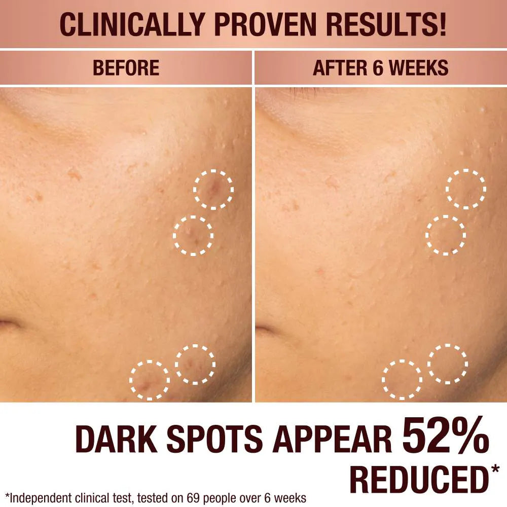 Charlotte - Tilbury Dark Spot Correcting Radiance Recovery Serum (Preorden)